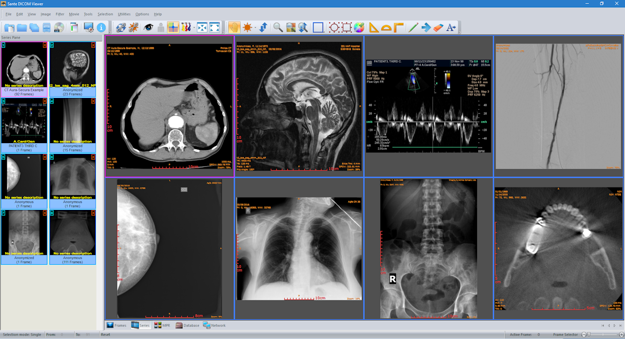 instal the new version for android Sante DICOM Viewer Pro 12.2.5